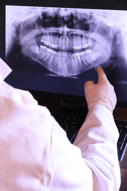 Best Emergency Broken Tooth Repair in Poseyville, IN