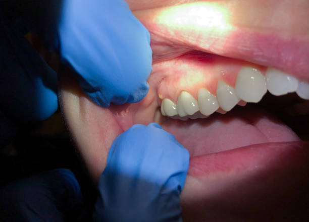 Best Urgent Dental Care in Poseyville, IN