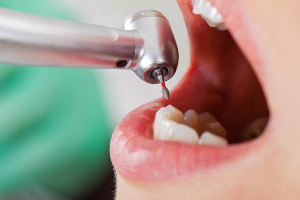 Best Pediatric Emergency Dentist in Poseyville, IN